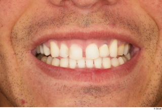 George Lee teeth 0001.jpg